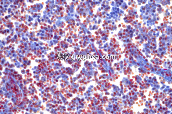 Ganglion lymphatique x160 - gryphea.com